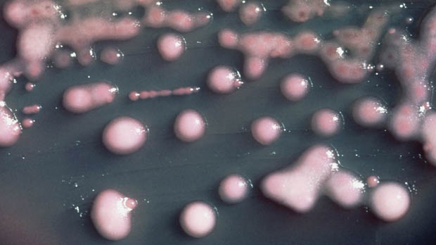 Superbug outbreak Toronto area hospitals Ontario