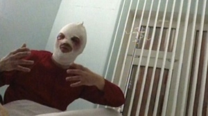Bolshoi Theater director Sergei Filin acid attack