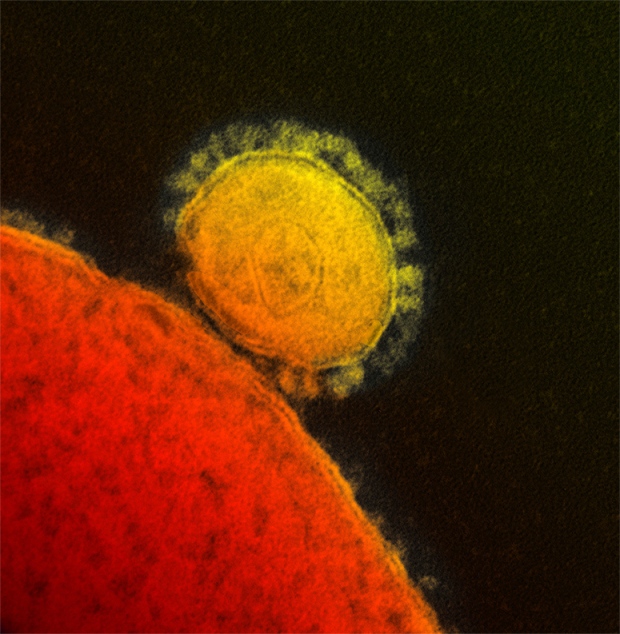 Novel coronavirus electron micrograph