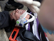 A man injured after an explosion near a bus stop in Jerusalem, Wednesday, March 23, 2011 is treated on the street. (AP Photo/Bernat Armangue)