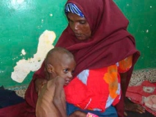 A Somali woman from southern Somalia hold her malnourished child in Banadir hospital in Mogadishu, Somalia, Thursday, July 21, 2011. Somalia's 20-year-old civil war is partly to blame for turning the drought in the Horn of Africa into a famine. Analysts warned that aid agencies could be airlifting emergency supplies to the failed state 20 years from now unless the U.N.-backed government improves.(AP Photo/Farah Abdi Warsameh)