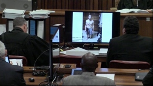 Court shown photos of bloodied prosthetics