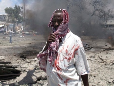 A wounded man stands at the scene of an explosion in Mogadishu, Somalia, Tuesday, Oct. 4, 2011. (AP Photo/Mohamed Sheikh Nor)