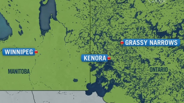 CTV News Channel: Grassy Narrows mercury poisoning