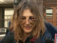 Occupy Toronto protester Angela Turvey speaks to reporters after she was released on bail Saturday, March 31, 2012. Turvey alleges police brutality in her arrest, which occurred a day earlier.