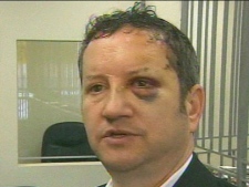 A battered Harold Gerstel talks to CP24 on Tuesday, April 24, 2012 about how he was attacked during a robbery.