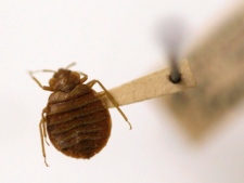 A bed bug is pictured. (AP Photo/Carolyn Kaster, File)