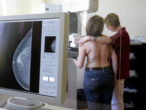 Mammogram file 