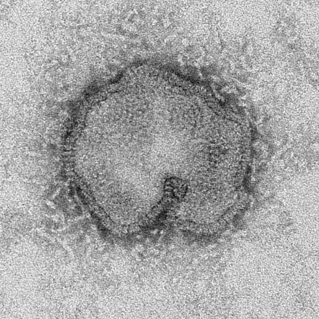 H7N9 bird flu virus