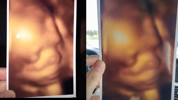 Ultrasound pictures from BabyView