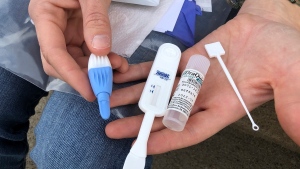 HIV testing kit