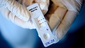 A health worker shows a positive 'SARS-CoV-2 Rapid Antigen' test just after collecting a nose swab sample for a polymerase chain reaction (PCR) at the coronavirus testing facility of Unisante, the university center for general medicine and public health, in Lausanne, Switzerland, Monday, Nov. 9, 2020. (Laurent Gillieron/Keystone via AP)