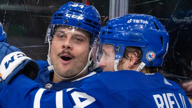 Auston Matthews Lost A Tooth After This Play 