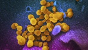 FILE - This undated, colorized electron microscope image made available by the U.S. National Institutes of Health in February 2020 shows the Novel Coronavirus SARS-CoV-2, indicated in yellow, emerging from the surface of cells, indicated in blue/pink, cultured in the lab. The sample was isolated from a patient in the U.S. On Thursday, April 21, 2022, scientists reported a U.K. patient with a severely weakened immune system had COVID-19 for almost a year and a half, underscoring the importance of protecting vulnerable people from the coronavirus. (NIAID-RML via AP, File)
