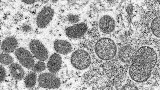 This 2003 electron microscope image made available by the Centers for Disease Control and Prevention shows mature, oval-shaped monkeypox virions, left, and spherical immature virions, right, obtained from a sample of human skin associated with the 2003 prairie dog outbreak. On Wednesday, May 18, 2022, Portuguese health authorities confirmed five cases of monkeypox in young men, marking an unusual outbreak in Europe of a disease typically limited to Africa. (Cynthia S. Goldsmith, Russell Regner/CDC via AP)