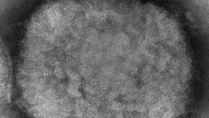 FILE - This 2003 electron microscope image made available by the Centers for Disease Control and Prevention shows a monkeypox virion, obtained from a sample associated with the 2003 prairie dog outbreak. The U.S. government is building up its supply of monkeypox vaccine to contend with escalating cases identified in a surprising international outbreak, health officials said Friday, June 10, 2022. (Cynthia S. Goldsmith, Russell Regner/CDC via AP, File)