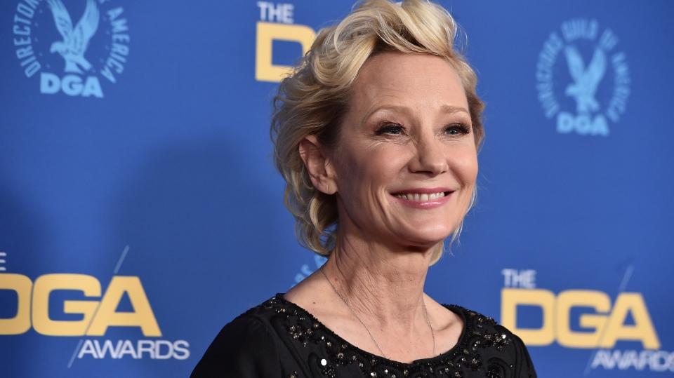 Anne Heche is 'brain dead' but remains on life support for organ ...
