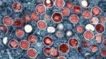 This image provided by the National Institute of Allergy and Infectious Diseases (NIAID) shows a colorized transmission electron micrograph of monkeypox particles (red) found within an infected cell (blue), cultured in the laboratory that was captured and color-enhanced at the NIAID Integrated Research Facility (IRF) in Fort Detrick, Md.  (NIAID via AP)