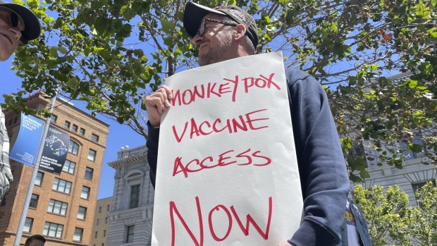 Still no monkeypox vaccine for Africa | CP24.com