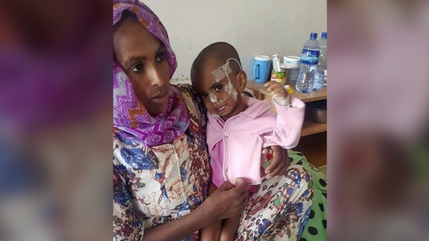Ethiopia malnutrition babies