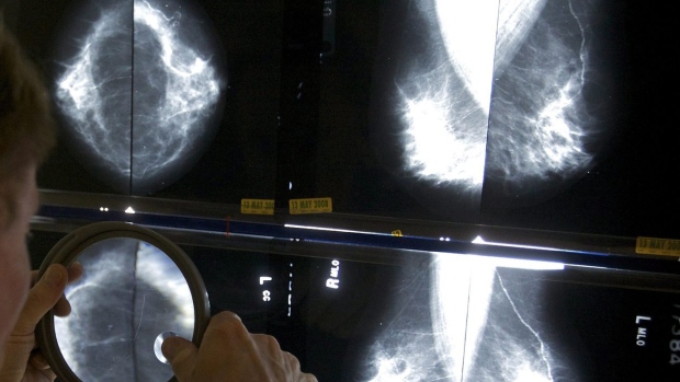 400,000 mamografías menos realizadas durante la pandemia: Asociación Médica de Ontario