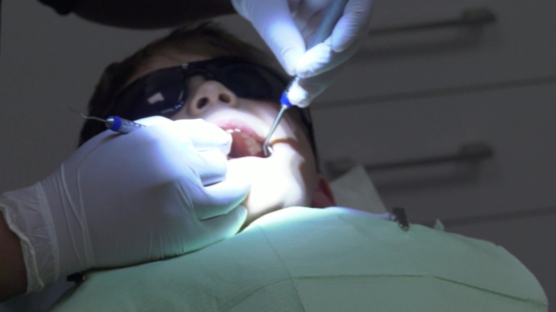 Federal dental insurance program to be phased in over 2024, benefits to start in May
