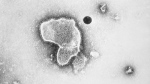An electron micrograph of Respiratory Syncytial Virus, also known as RSV, is seen in a Centers for Disease Control and Prevention (CDC) 1981 handout image. As pediatric hospitals fill up with young children sickened by respiratory syncytial virus (RSV), doctors are worried that elderly adults will be the next wave to become seriously ill. THE CANADIAN PRESS/AP-HO, CDC