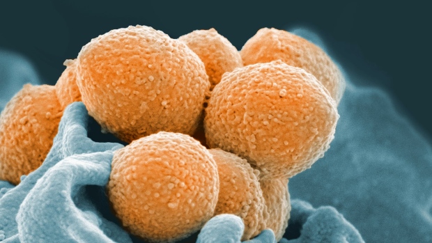 Group A Streptococcus