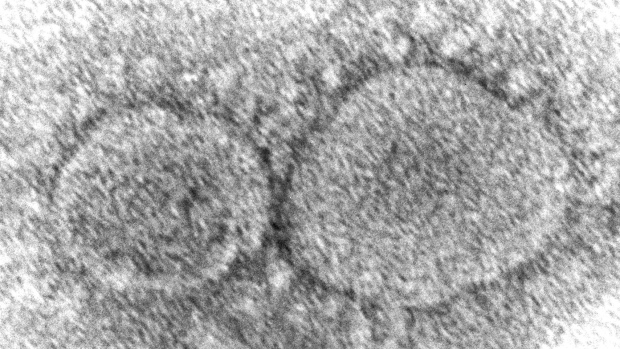 SARS-CoV-2 virus particles