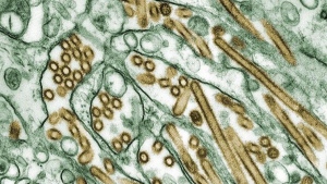 Colorized transmission electron micrograph of Avian influenza A H5N1 viruses (seen in gold) grown in MDCK cells (seen in green) as shown in this undated handout photo. The Toronto Zoo has shut down some of its bird enclosures after a bird flu case was detected at a southern Ontario poultry farm. THE CANADIAN PRESS/HO-CDC/Cynthia Goldsmith via NIH