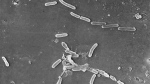 FILE - This scanning electron microscope image made available by the Centers for Disease Control and Prevention shows rod-shaped Pseudomonas aeruginosa bacteria. U.S. officials are reporting two more deaths and additional cases of vision loss linked to eyedrops tainted with the drug-resistant bacteria. The eyedrops from EzriCare and Delsam Phama were recalled in February 2023 and health authorities are continuing to track infections as they investigate the outbreak. (Janice Haney Carr/Centers for Disease Control and Prevention via AP, File)
