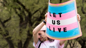 Eli Galvan, 29, of Virginia Beach, Va., reacts while listening to speakers during a rally as part of Transgender Day of Visibility, Friday, March 31, 2023, by the Capitol in Washington. "It's important to stop working against each other and to support each other," says Galvan, "we just want to be able to live, and not to feel that we are in a place where we are broken." (AP Photo/Jacquelyn Martin)