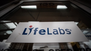 A sign is seen on the door at a LifeLabs location in Vancouver, Oct. 22, 2021. THE CANADIAN PRESS/Darryl Dyck