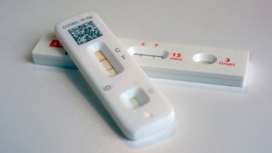In this file photo, COVID-19 antigen home tests indicating a positive result are photographed in New York, April 5, 2023. (AP Photo/Patrick Sison, File)