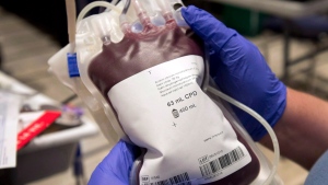 A bag of blood is shown at a clinic in Montreal, Thursday, November 29, 2012. Health Canada is lifting a longstanding ban on blood donations across the country that stemmed from fear of mad cow disease. THE CANADIAN PRESS/Ryan Remiorz