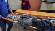 Palestinians wounded in the Israeli bombardment of the Gaza Strip are brought to the hospital in Deir al Balah on Sunday, Dec. 3, 2023. (AP Photo/ Hatem Moussa)