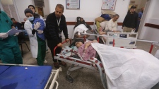 Wounded Palestinians