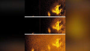 This photo combo provided by Deep Sea Vision shows a sonar image that appears to be Amelia Earhart's Lockheed 10-E Electra. A grainy sonar image recorded by a private pilot has reinvigorated interest in one of the past century's most alluring mysteries: What happened to Amelia Earhart when her plane vanished during her flight around the world in 1937? (Deep Sea Vision via AP)