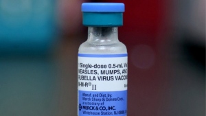 A measles vaccination is shown in Ohio in a May 2019 file photo. Public health officials are encouraging parents to ensure their children get routine childhood vaccines as measles continues to spread around the world. THE CANADIAN PRESS/AP/Paul Vernon
