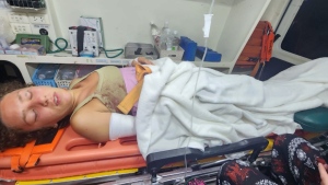 B.C. woman facing bills, amputation after crash in