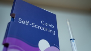 A cervix self-screening kit is a part of the first self-screening cervical cancer plan in Canada, in Vancouver, Tuesday, Jan. 9, 2024. THE CANADIAN PRESS/Ethan Cairns
