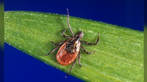 This undated photo provided by the U.S. Centers for Disease Control and Prevention (CDC) shows a black-legged tick. THE CANADIAN PRESS/AP-CDC via AP