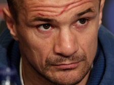 In this June 10, 2010, file photo, UFC fighter Mirko "Cro Cop" Filipovic sports a fresh cut on his forehead during a news conference for UFC 115 in Vancouver, British Columbia. (AP Photo/The Canadian Press, Darryl Dyck, FIle)