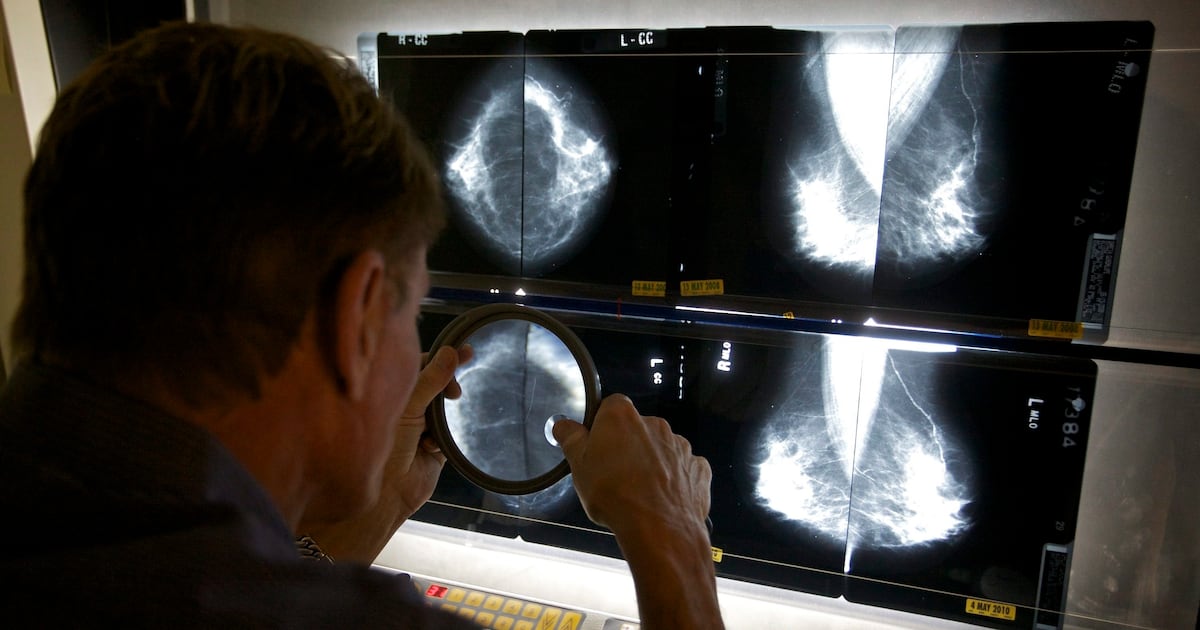 Cancer incidence and mortality rates decline across Canada ...