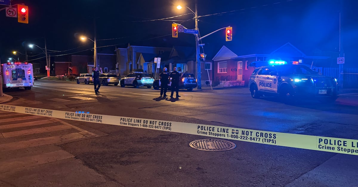 Victim assaulted in Toronto’s west end sustained large cuts during attack, police say