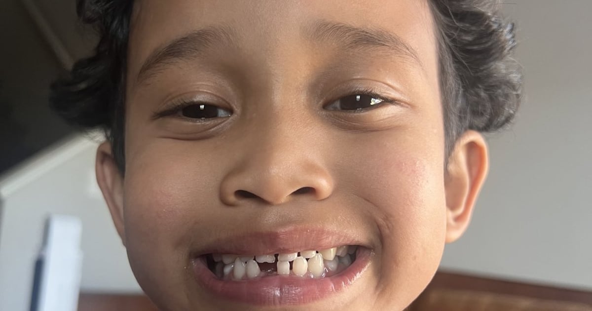 Food Allergy Canada urges laws requiring schools to stock epinephrine
