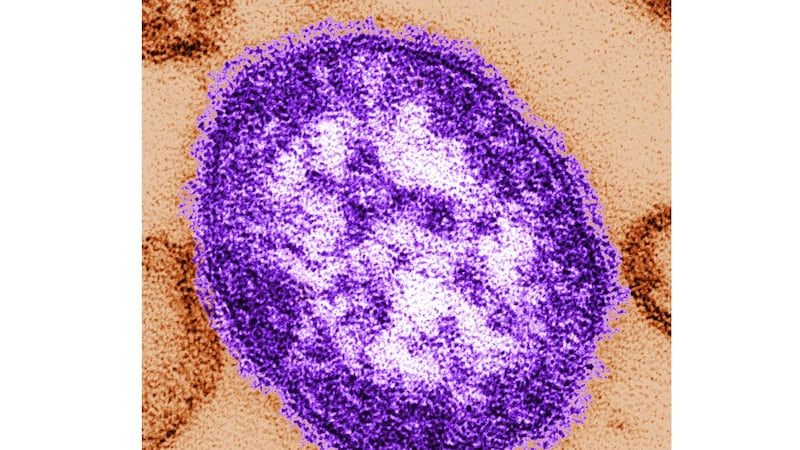 Did you visit this hospital? York Region Public Health confirms measles case