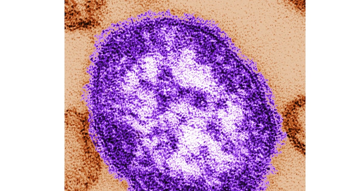 York Region Confirms Measles Exposure at Vaughan Hospital