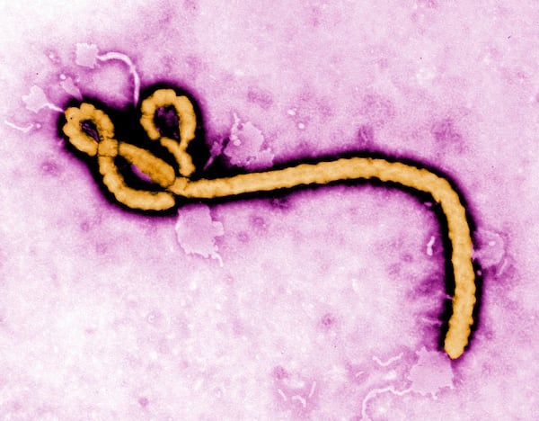 Ontario resident who recently travelled to East Africa being tested for Ebola virus
