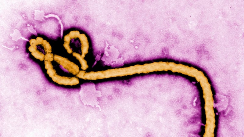 Ebola virus in Ontario: one person who travelled to East Africa being ...